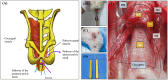 (A) Anatomical diagram of pelvic muscles showing coccygeal and pubococcygeal muscles with pathways of pelvic mesh. (B) Close-up of a tool inserted in an animal model. (C) Surgical site on an animal, showing stitches. (D) Two surgical tools with hook ends. (E) Surgical exposure of muscle layers with labeled areas PM, UF, VA, Re, and Coccygeus.