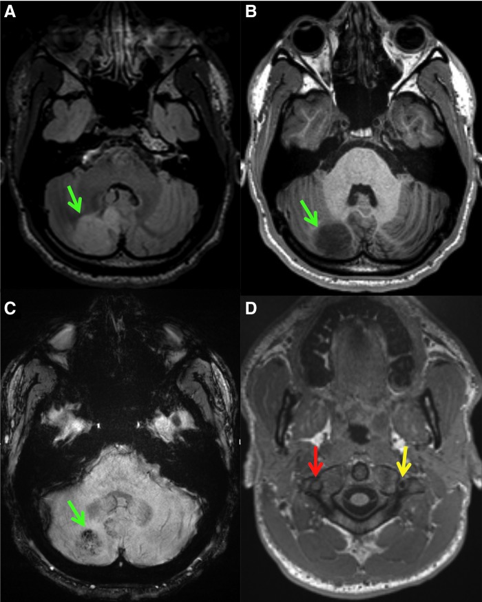 FIG. 2.