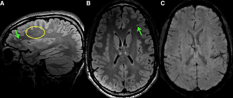 FIG. 1.