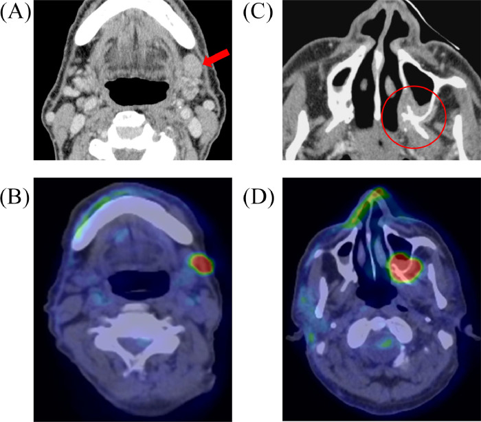 Fig 1