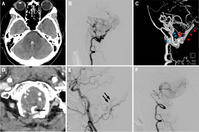 Fig. 2