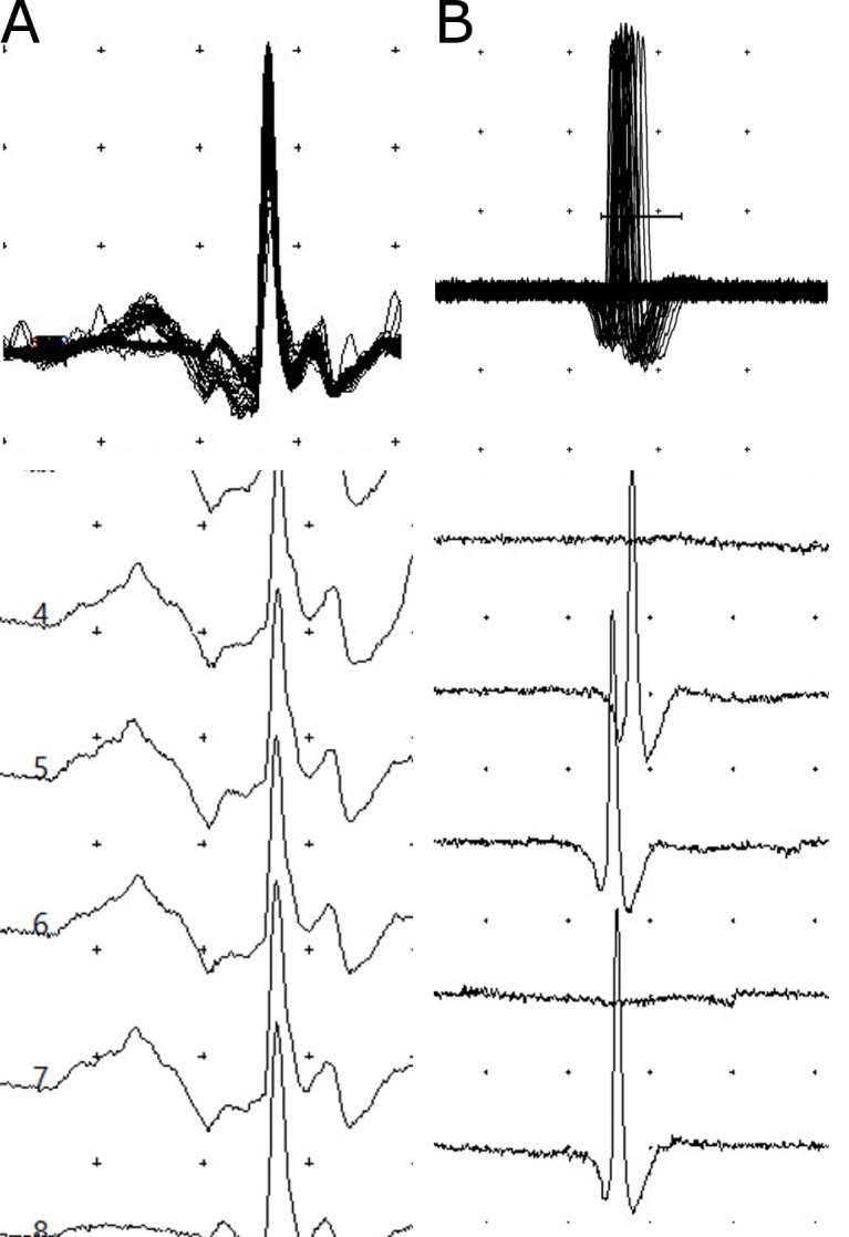 Fig 3