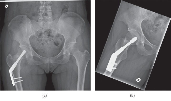 Figure 2