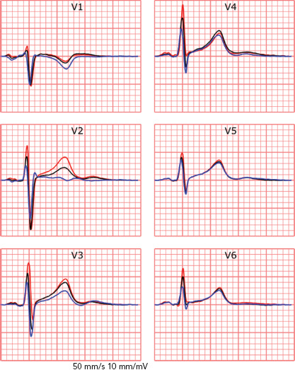 Figure 2: