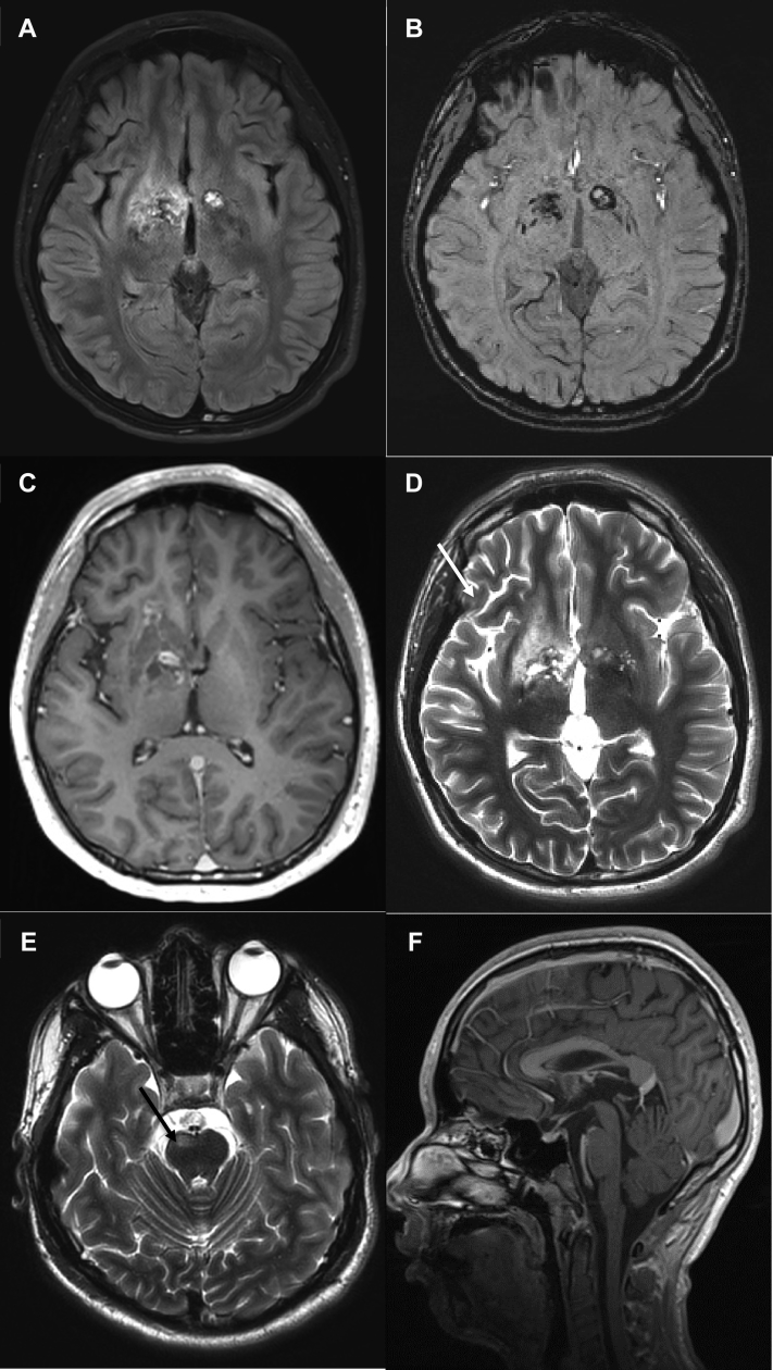 Fig. 1