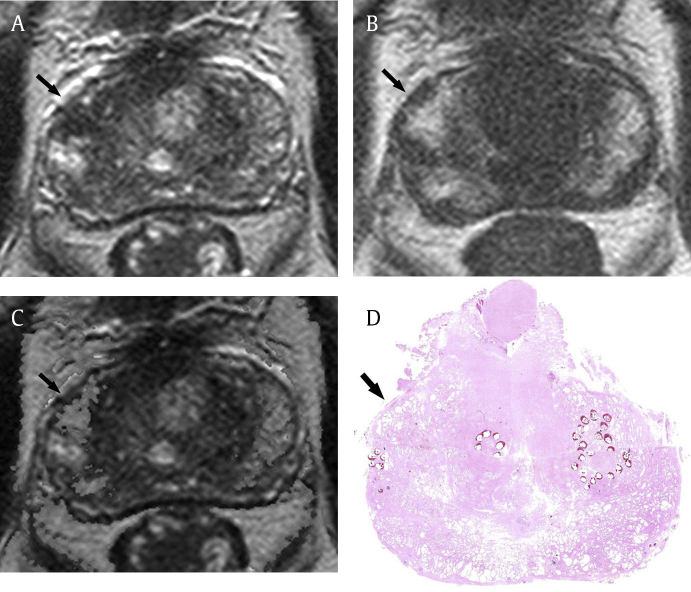 Fig. 4