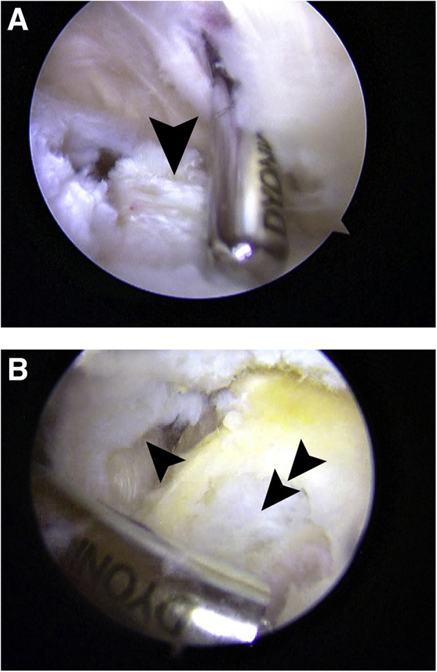 Fig 4