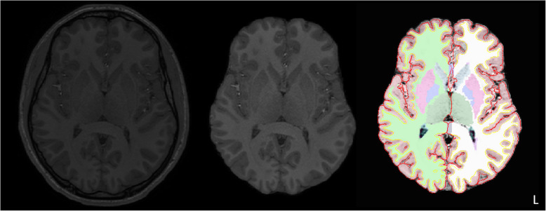 Fig. 1