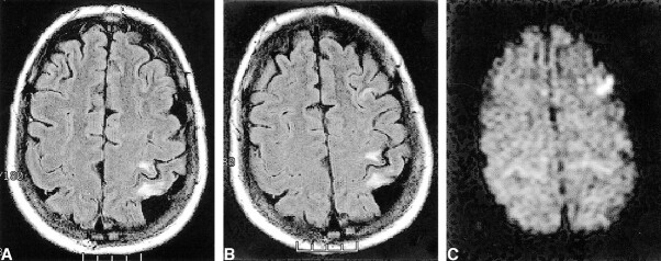 fig 1.