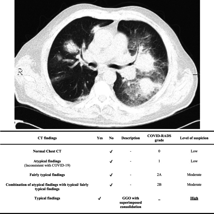 Fig. 4