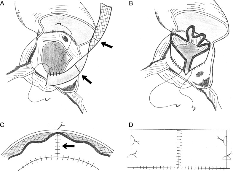 Figure 1: