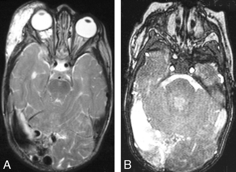 Fig 5.