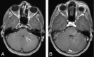 Fig 2.