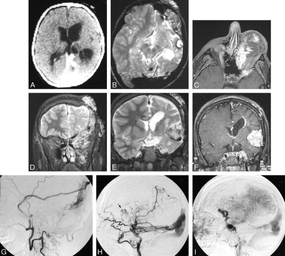 Fig 6.