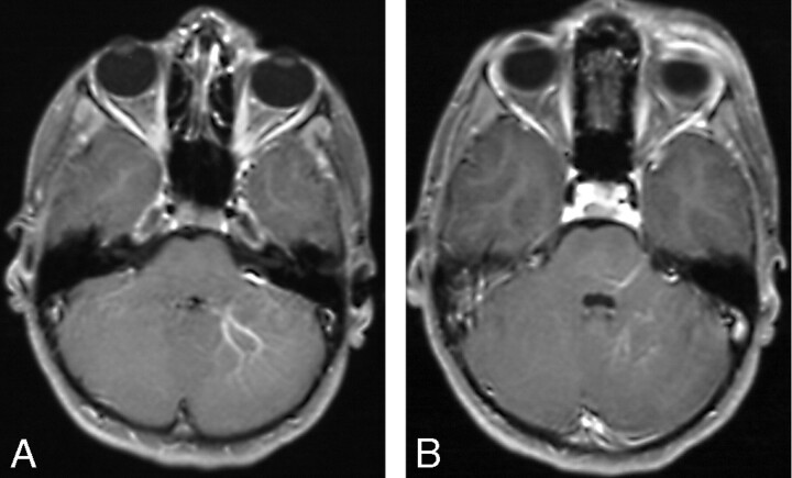 Fig 2.