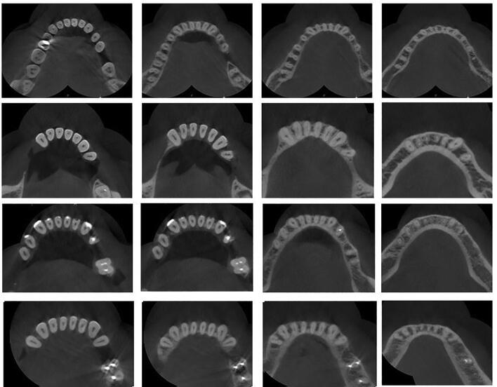 Fig. 3