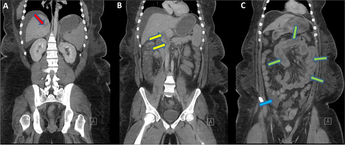 Fig. 1