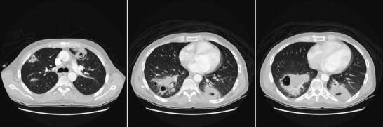 Fig. 12.4