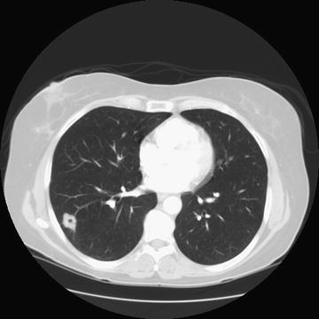 Fig. 12.2