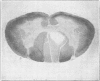 215
