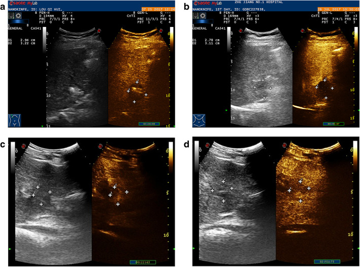 Fig. 1