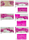 Fig. 12