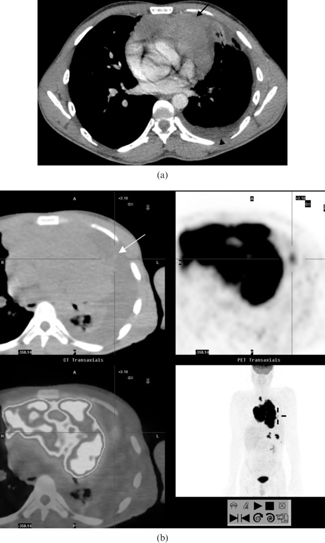 Figure 17