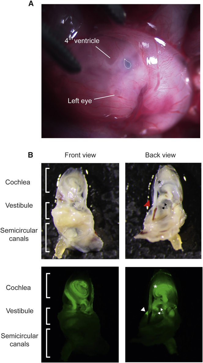 Figure 1