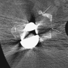 Fig. 4