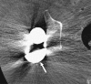 Fig. 3