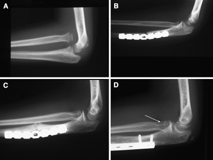 Fig. 2