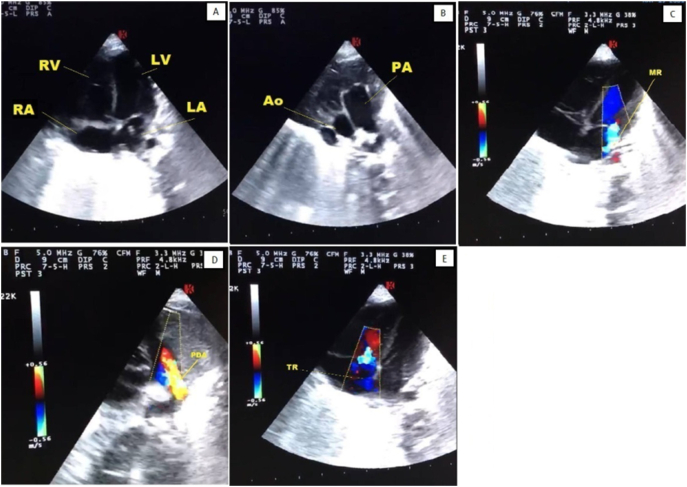 Fig. 3