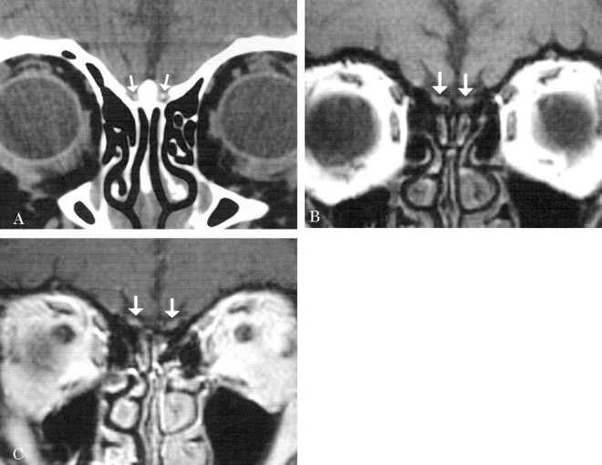 Fig 3.