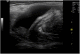 Figura 5