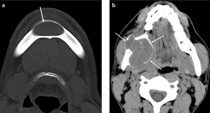 Figure 1. a, b.