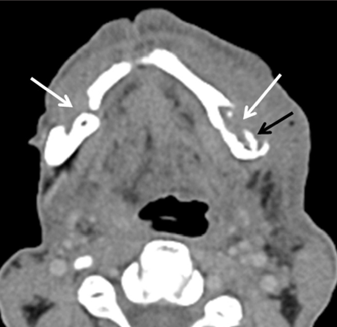 Figure 13.