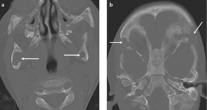 Figure 4. a, b.