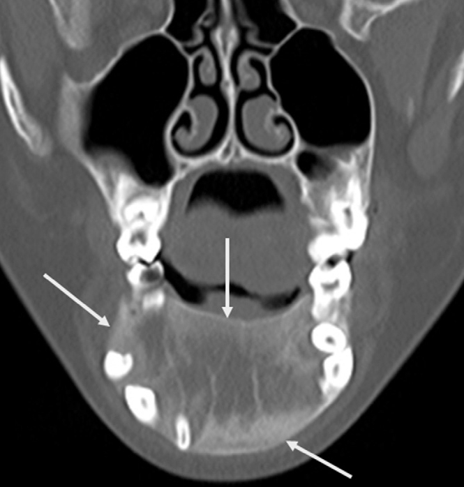 Figure 15.