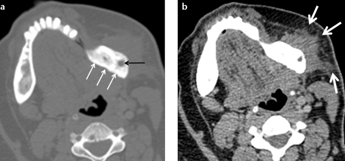 Figure 12. a, b.