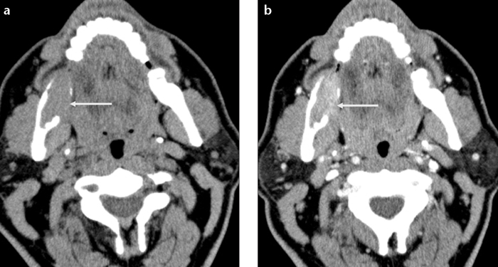 Figure 3. a, b.