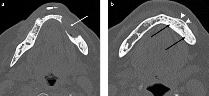 Figure 14. a, b.