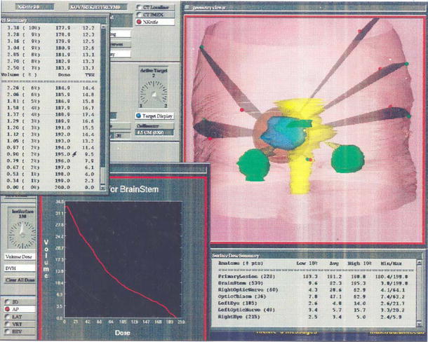 Fig. 1