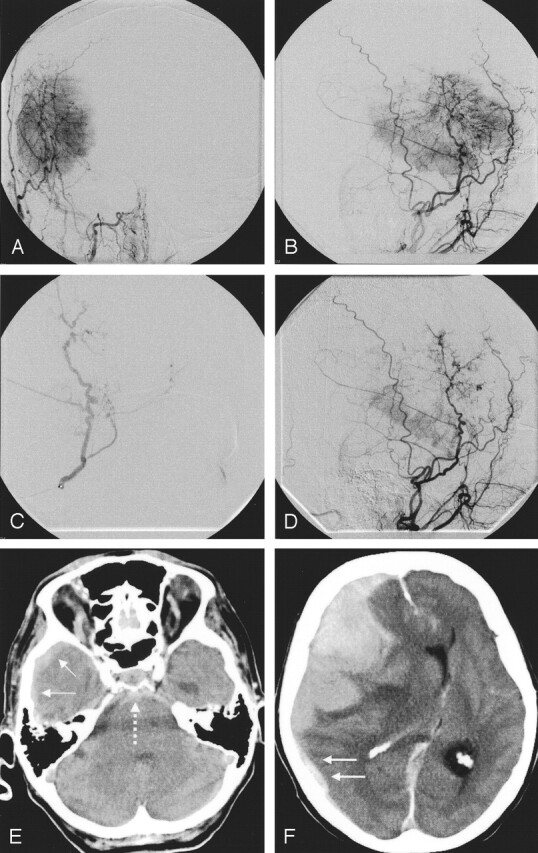 Fig 3.