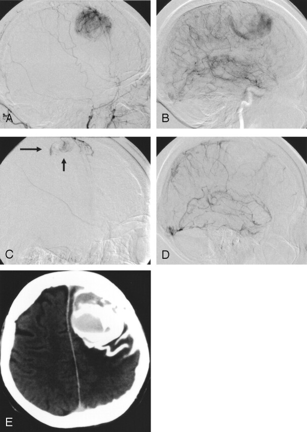 Fig 2.