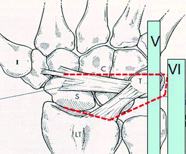 Fig. 2