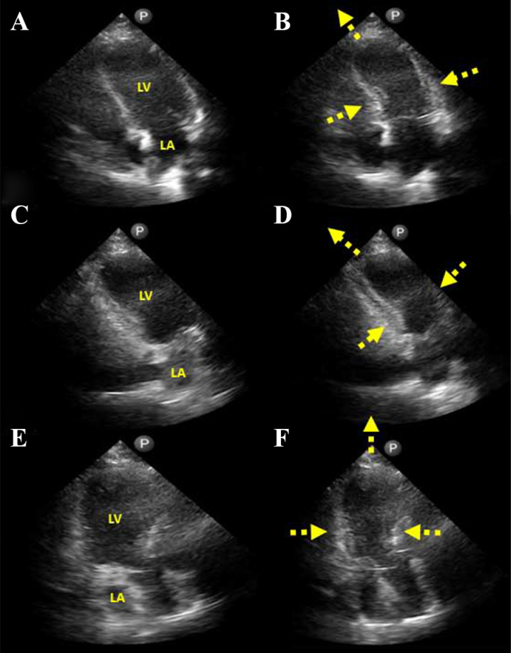Fig. (2)