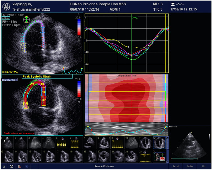 Fig. 2