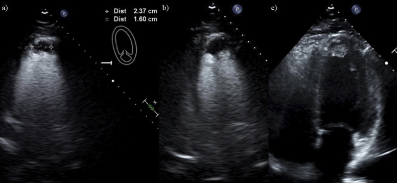 Figure 4