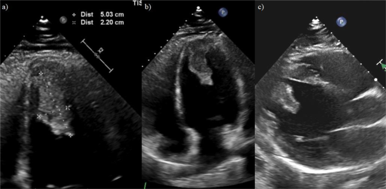 Figure 1