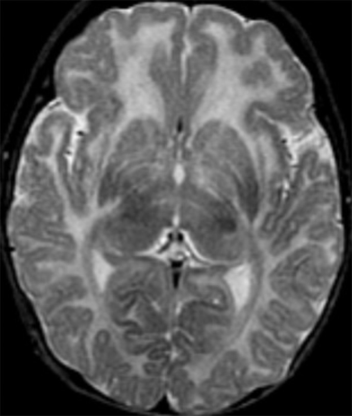 Figure 5e: